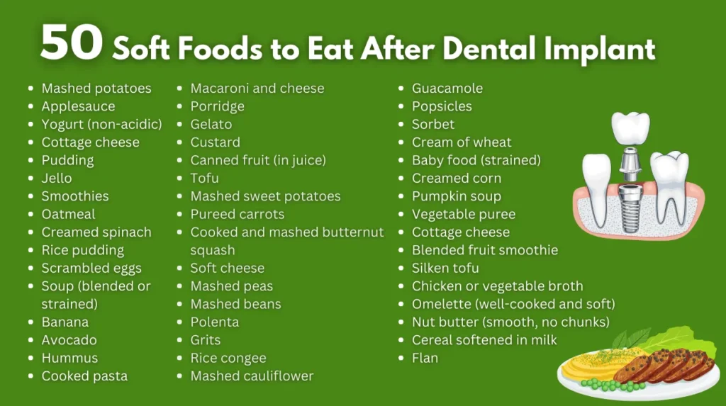 50 soft foods to eat after dental implant surgery