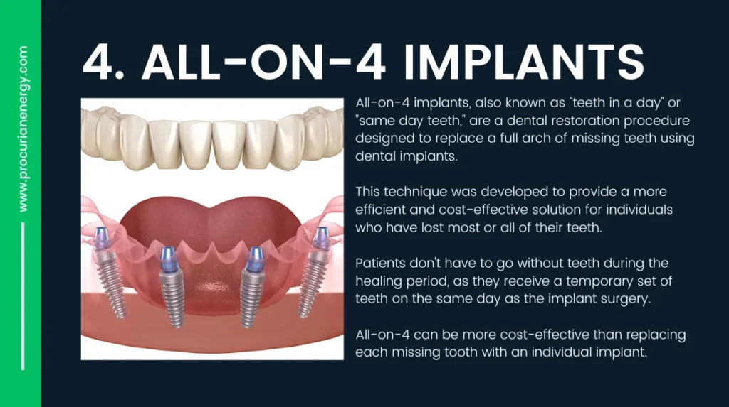 All-on-4 Implants-Alternative to Dental Implants
