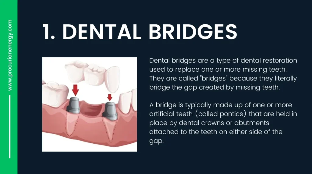 Dental Bridges-Alternative to Dental Implants