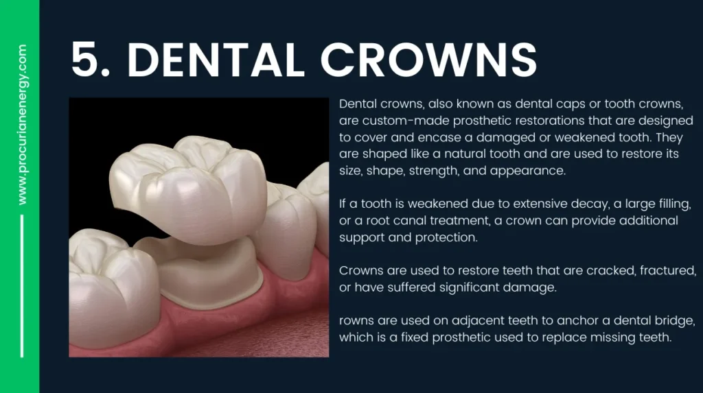 Dental Crowns-Alternative to Dental Implants