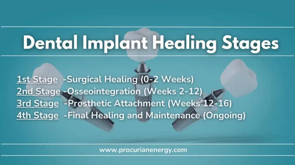 Dental Implant Healing Stages