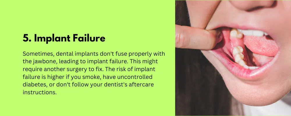 Implant Failure-Side Effect of Dental Implant