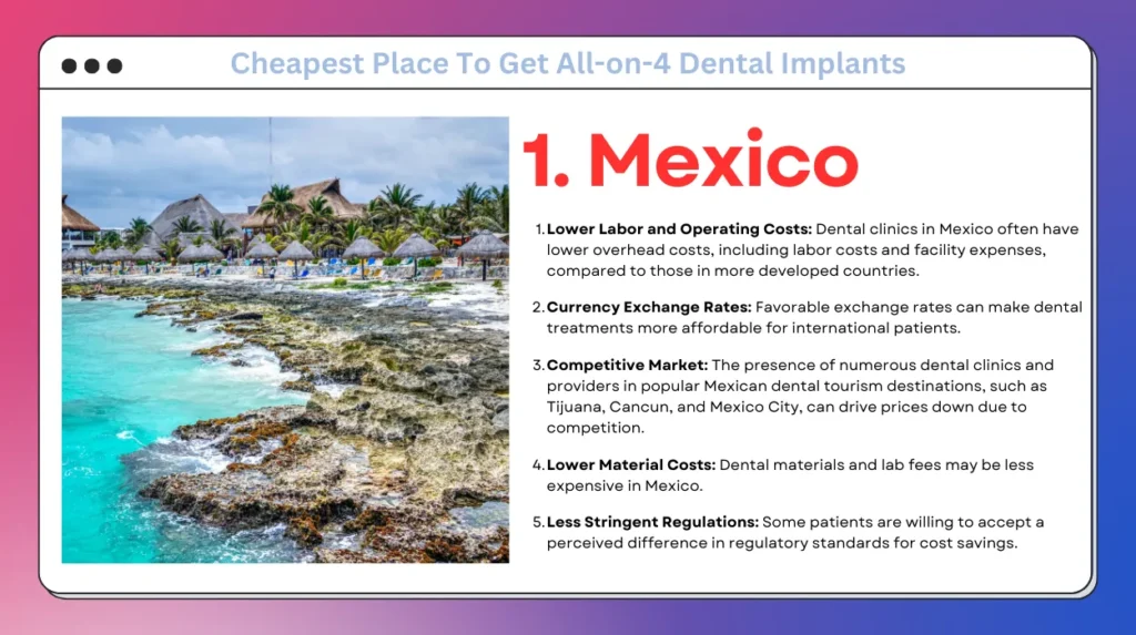 Mexico-Cheapest Place To Get All-on-4 Dental Implants