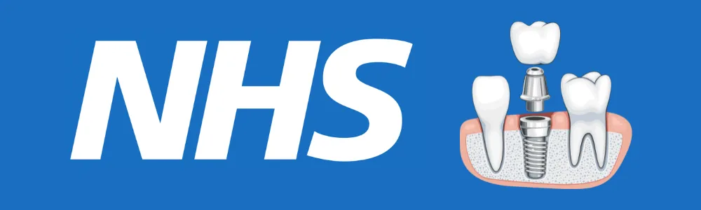 NHS to get Free Dental Implants UK