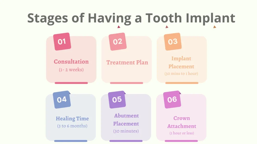 Stages of Having a Tooth Implant