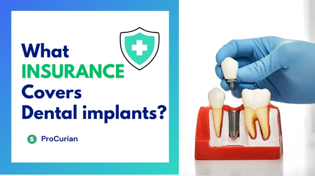Discover which insurance plans cover dental implants. Get insights on dental implant insurance options and how to maximize your oral health coverage.